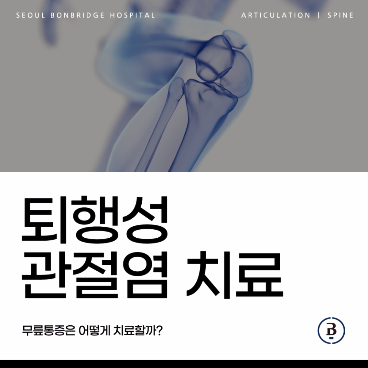 퇴행성관절염치료