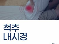 양방향 척추내시경