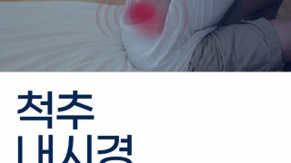 양방향 척추내시경